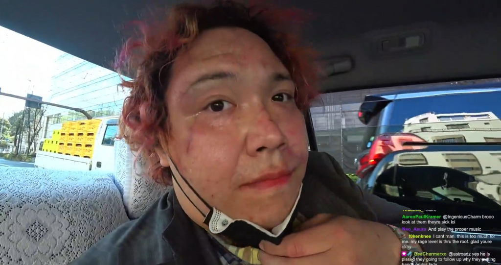 CashMeow shows how his face looked after being physically assaulted in Japan